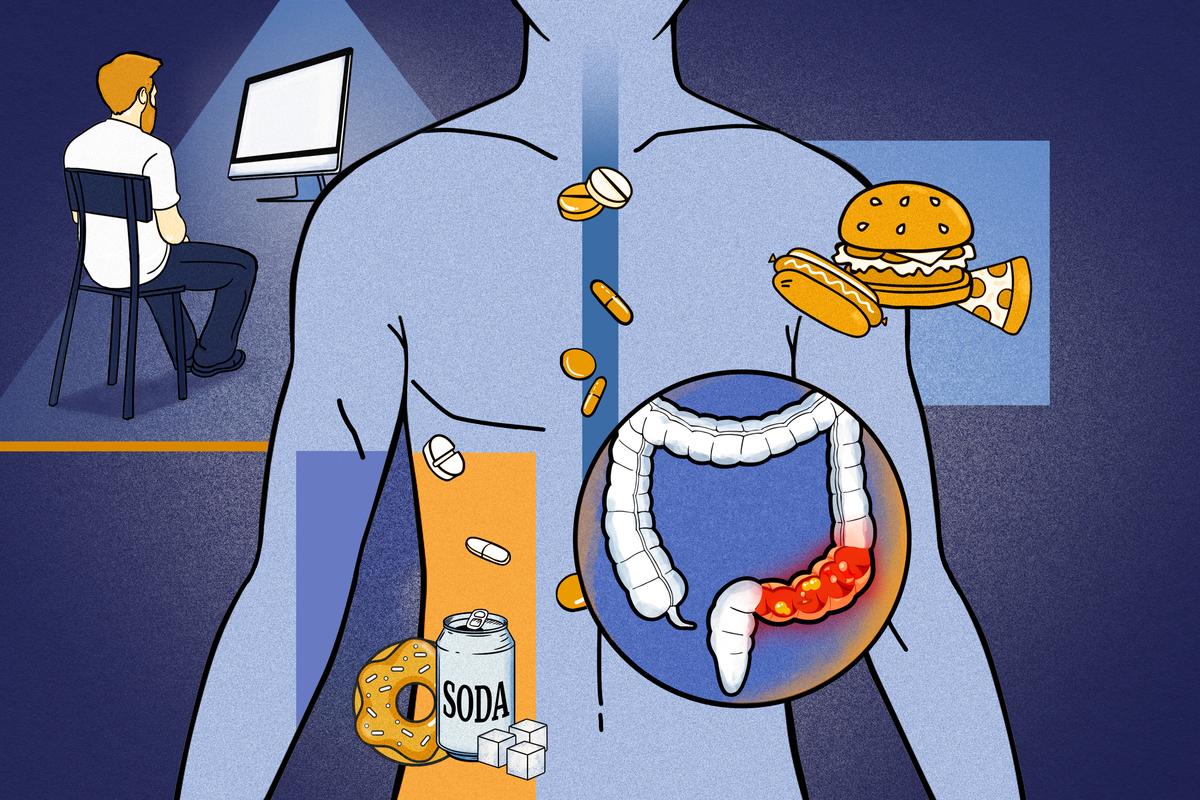 Colorectal Cancer Is Striking Young People, and ‘Some New Exposures’ May Be Fueling It thumbnail
