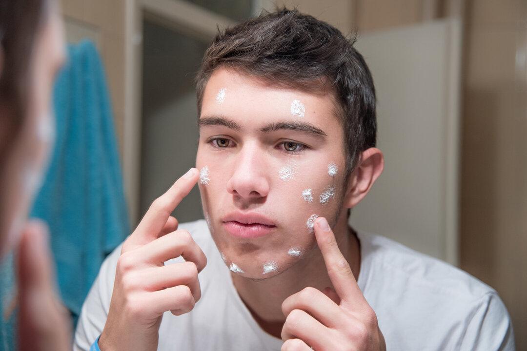 Cancer-Causing Agent Benzene Found in Popular Acne Treatments