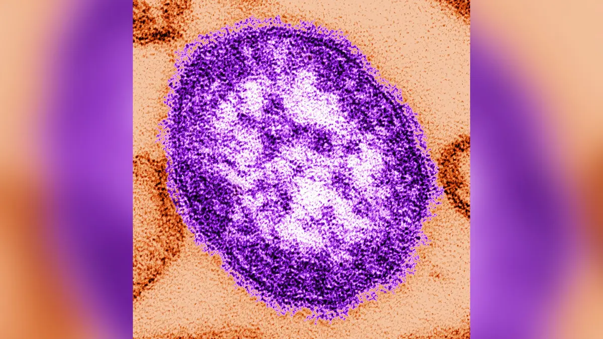 Officials Warn of Possible Measles Exposure at St. Louis Airport