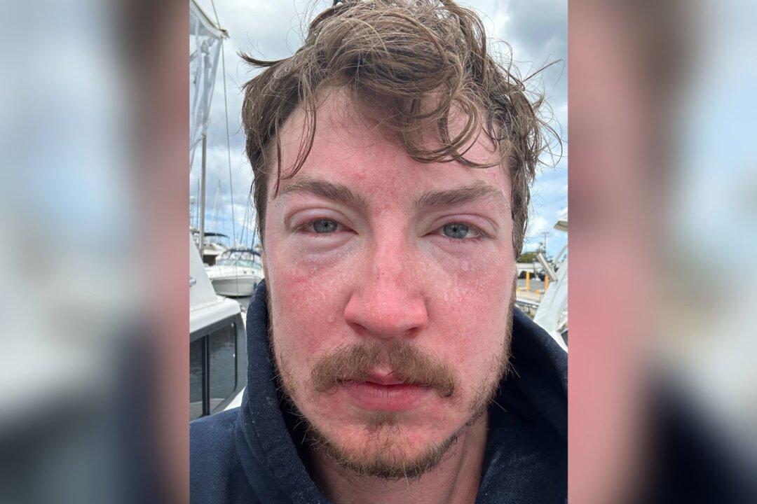 ‘Like a Hot Iron.’ BC Man’s Ultra-Marathon Hawaiian Swim Is Scuttled by Jellyfish