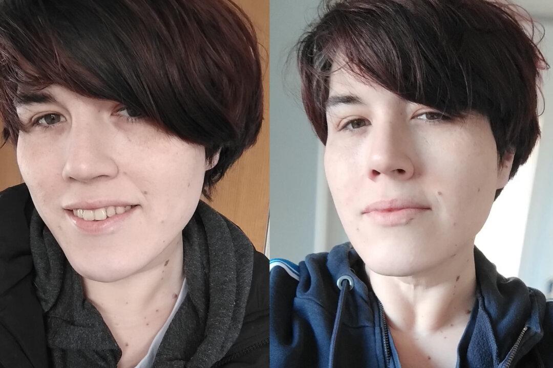 ‘Detransitioner’ Who Was Undiagnosed Autistic Calls for Reform of Adult Gender Services