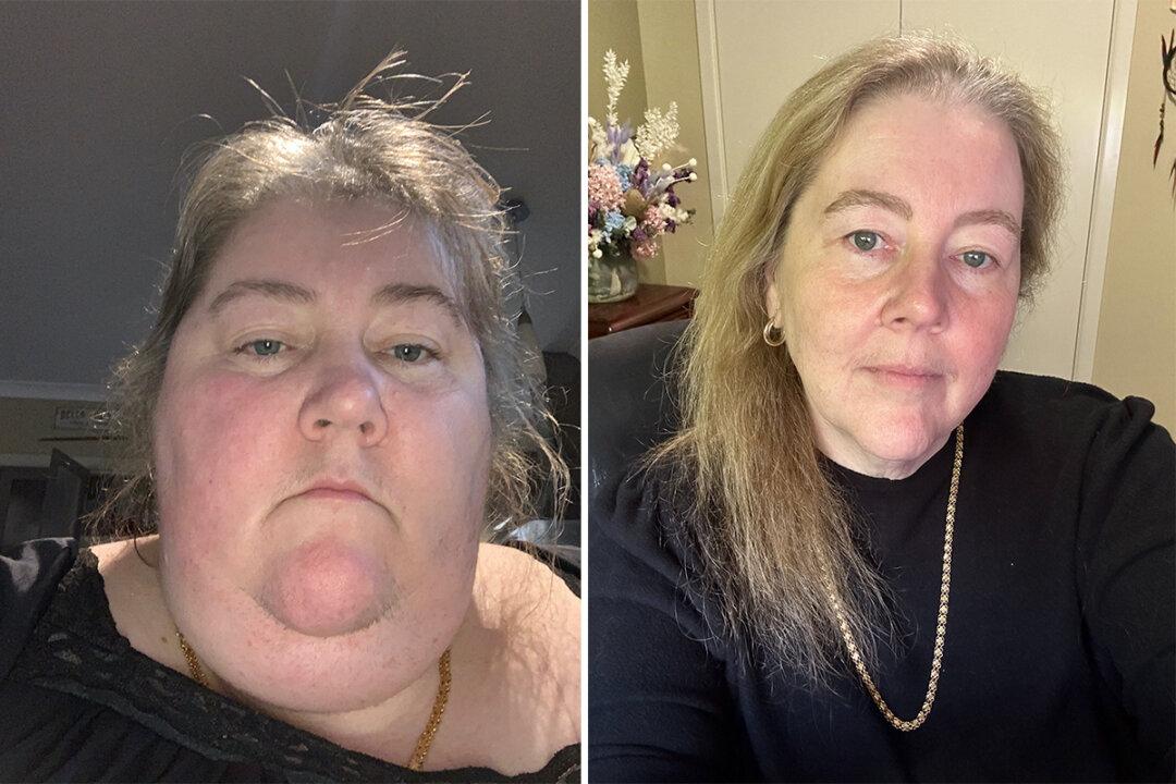 770lb Woman Who Was Housebound Sheds a Whopping 500lb—She’s Now Unrecognizable