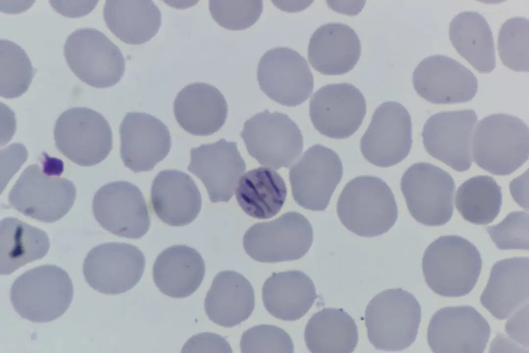 Southeastern Ontario Health Unit Probes 114 Cases of Parasitic Stomach Illness