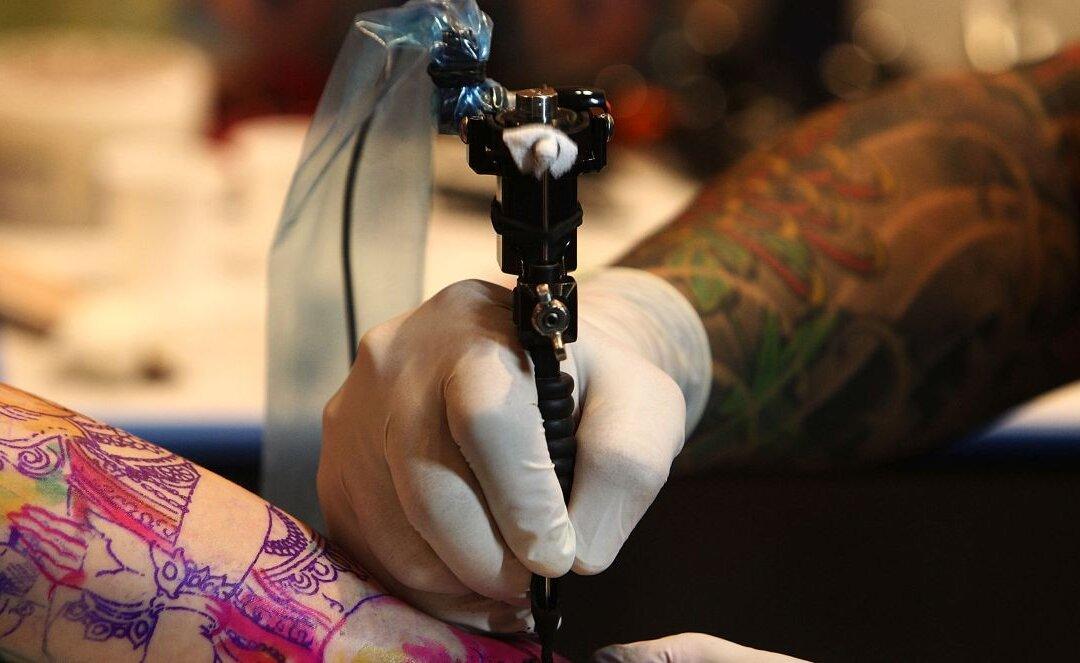 Tide Turns on Tattoos: Laser Removal Sees Massive Uptick