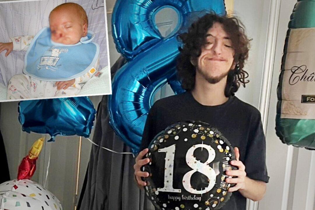 Mom Is Labeled ‘Cruel’ for Choosing Life for Her Son With a Rare Severe Cleft Lip, Now He’s a Happy, Healthy 18-Year-Old