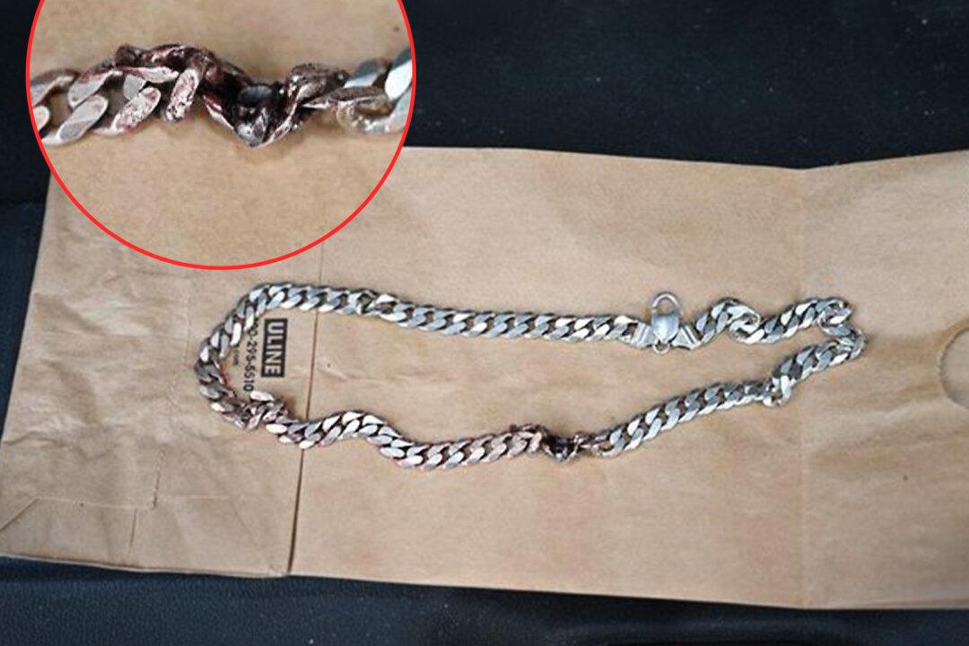 ‘Just Incredible’: Colorado Man’s Neck Chain Blocks Bullet From Gunshot, Saves His Life: Police