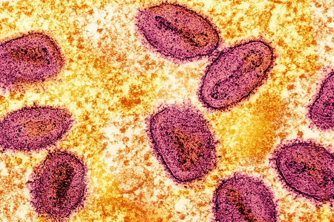 Severe Mpox Virus Strain Possibly Spreading in LA County, Officials Warn