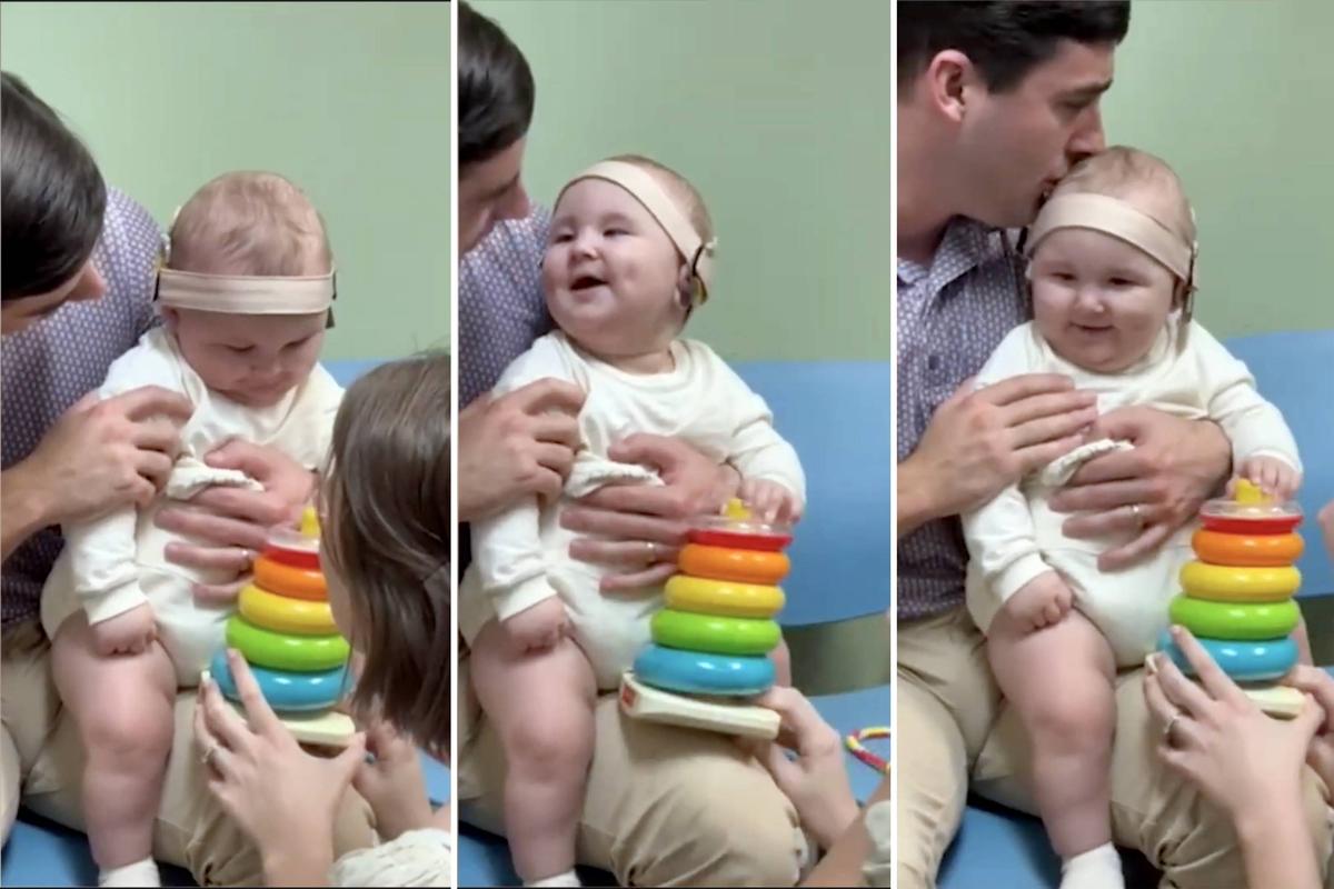 VIDEO: Baby Born Completely Deaf Hears His Parents’ Voices for the First Time