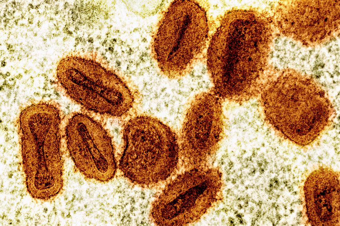 New Monkeypox Strain Detected in US for First Time