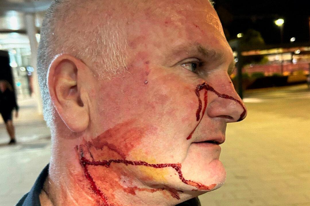 Woman Arrested After Allegedly Stabbing Officer in the Face With Pen