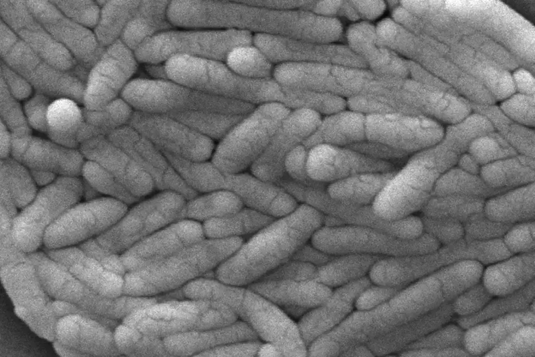 CDC Links New Salmonella Outbreak to Pet Chameleons