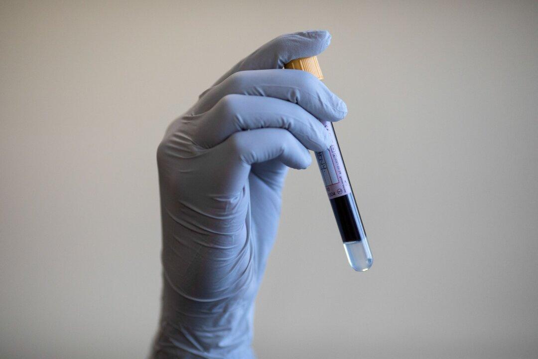 Blood Test Helps Predict Dementia Up to 25 Years in Advance, Study Suggests