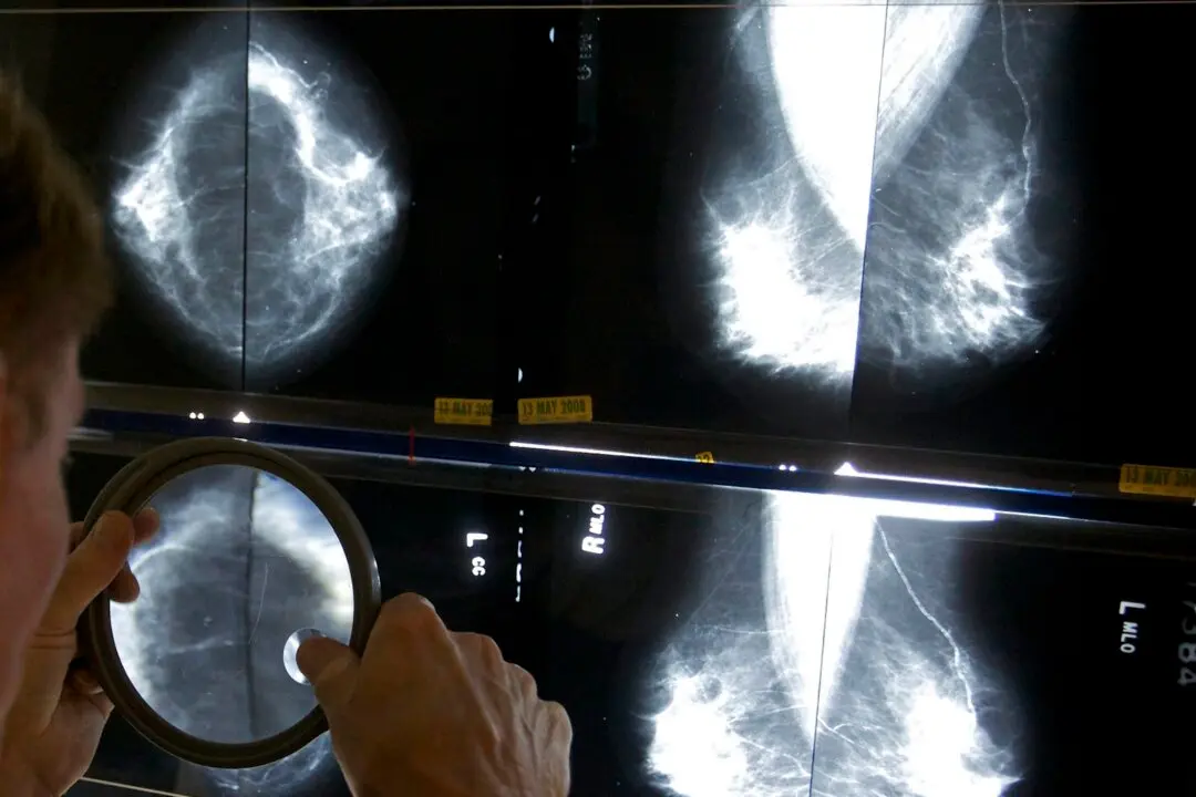 How Breast Cancer Rates Vary by Region in Canada