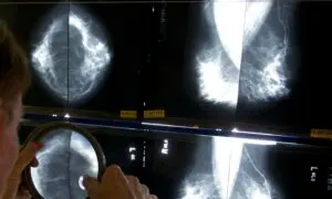 How Breast Cancer Rates Vary by Region in Canada