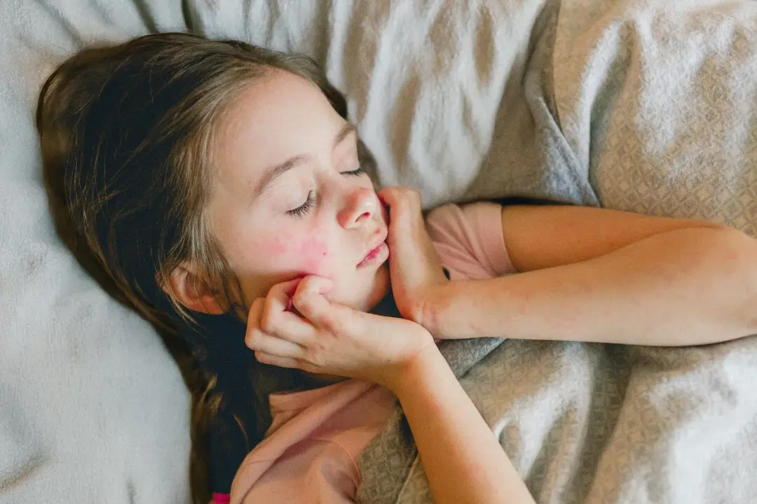Eczema Is More Than “Dry Skin”: 5 Practical Tips You Can Apply