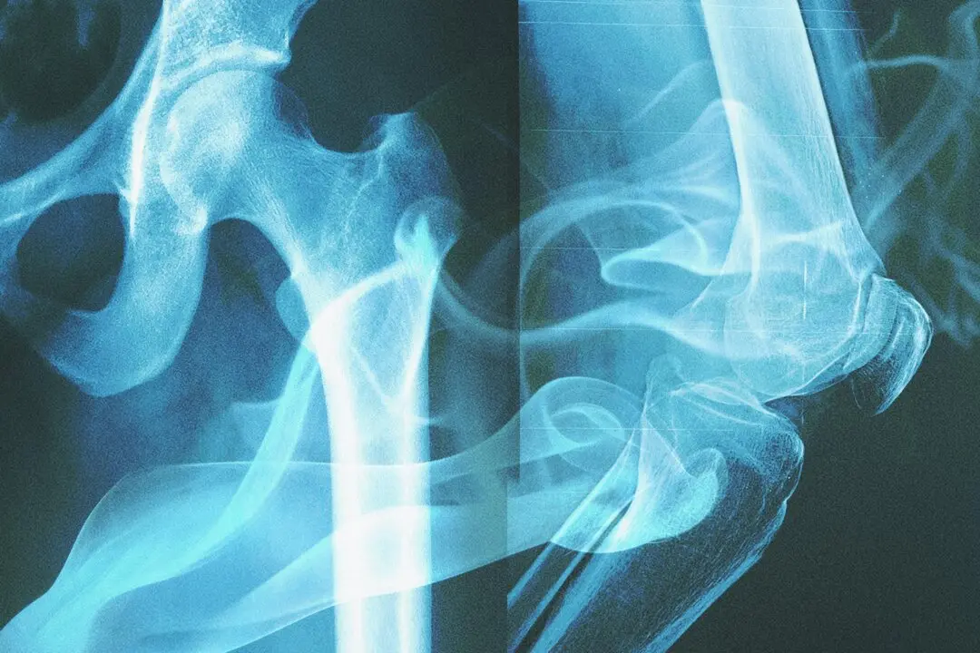 Your Bones ‘Remember’ the Cigarettes You Smoked