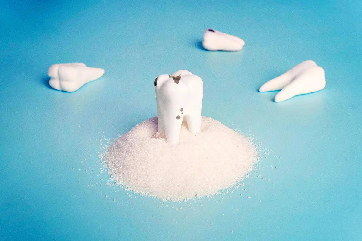 High Blood Sugar Can Sweeten Your Saliva, Increase Cavity Risk thumbnail