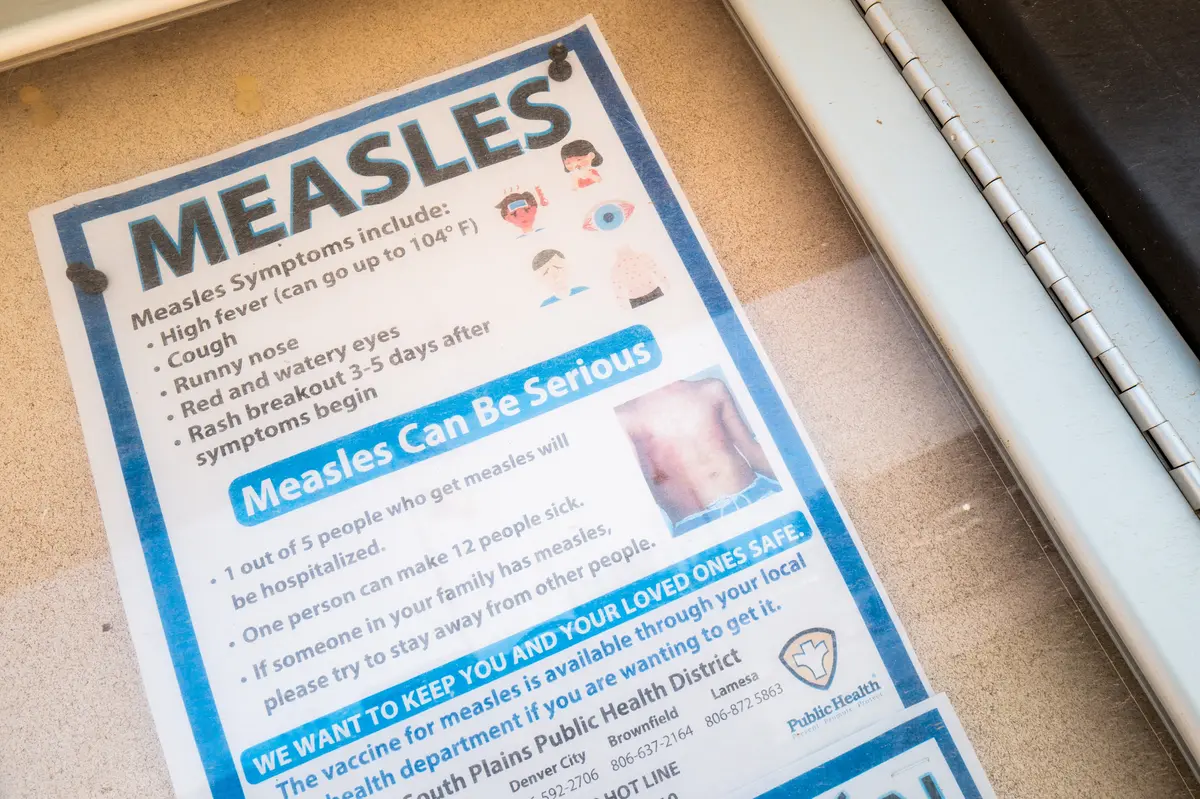 Cases of Measles in US Surpass 2,000 for First Time in More Than 30 Years thumbnail