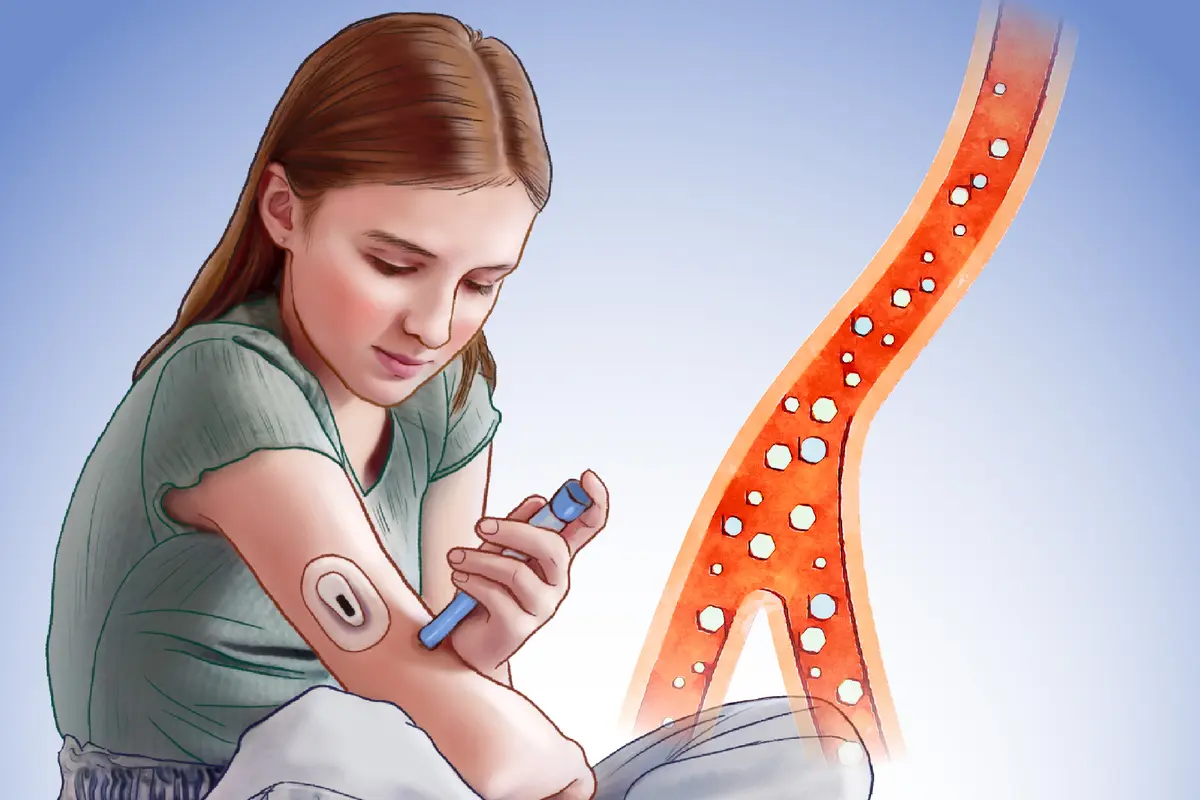 Type 1 Diabetes: A Common Autoimmune Condition–Here Are the Causes