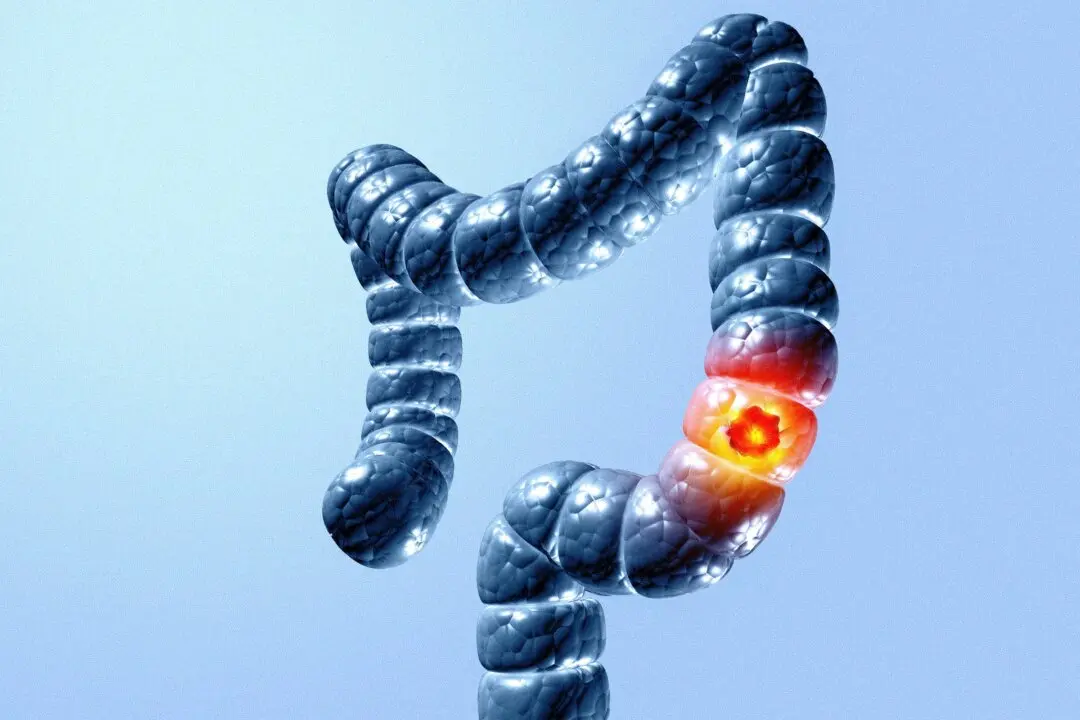 The Cancer Killing More Young Americans Than Any Other–and Why Screening Isn’t Catching It