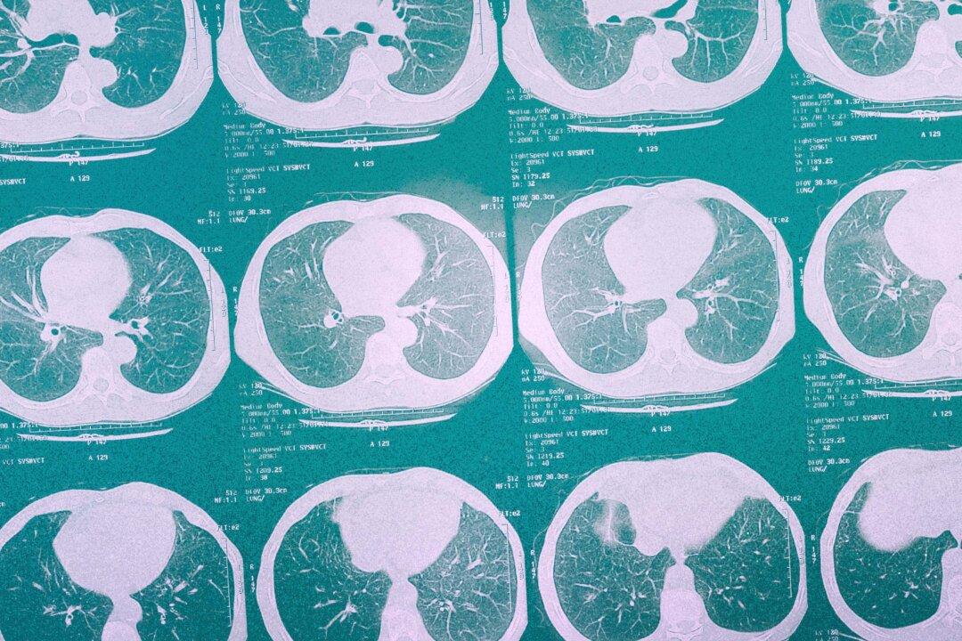 This Aggressive Lung Cancer Often Hides Until It’s Too Late