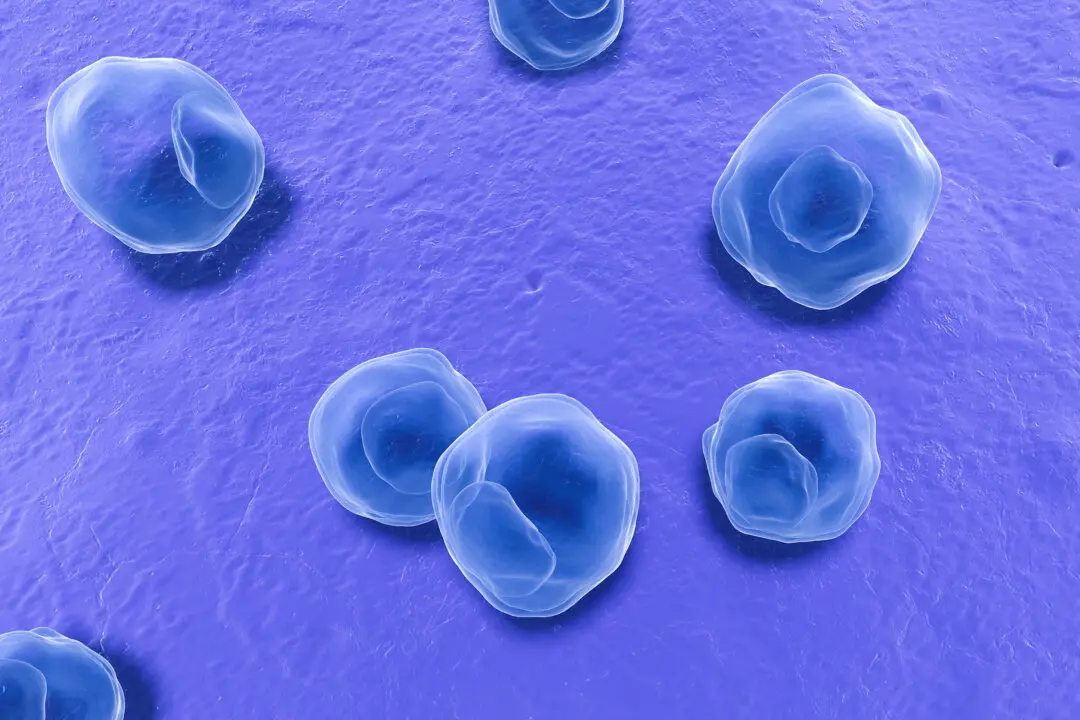 Common Bacteria Linked to Alzheimer’s Disease