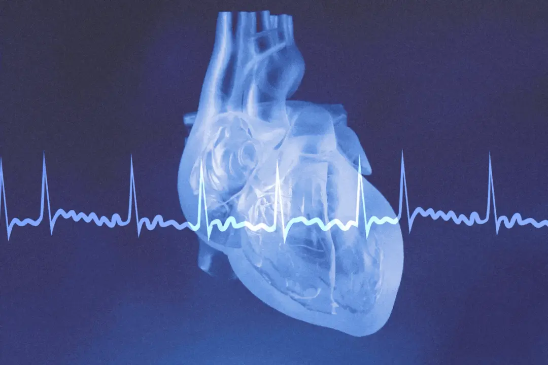 Racing Heart: Warning Sign or False Alarm? Expert Advice for Critical Situations