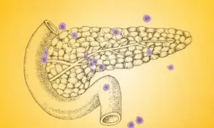 7 Overlooked Warning Signs of Pancreatic Cancer