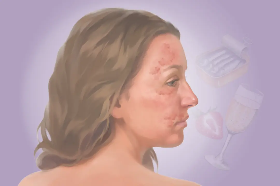 Histamine Intolerance: An Underrecognized Condition That Can Affect Multiple Organs–Here Are the Causes