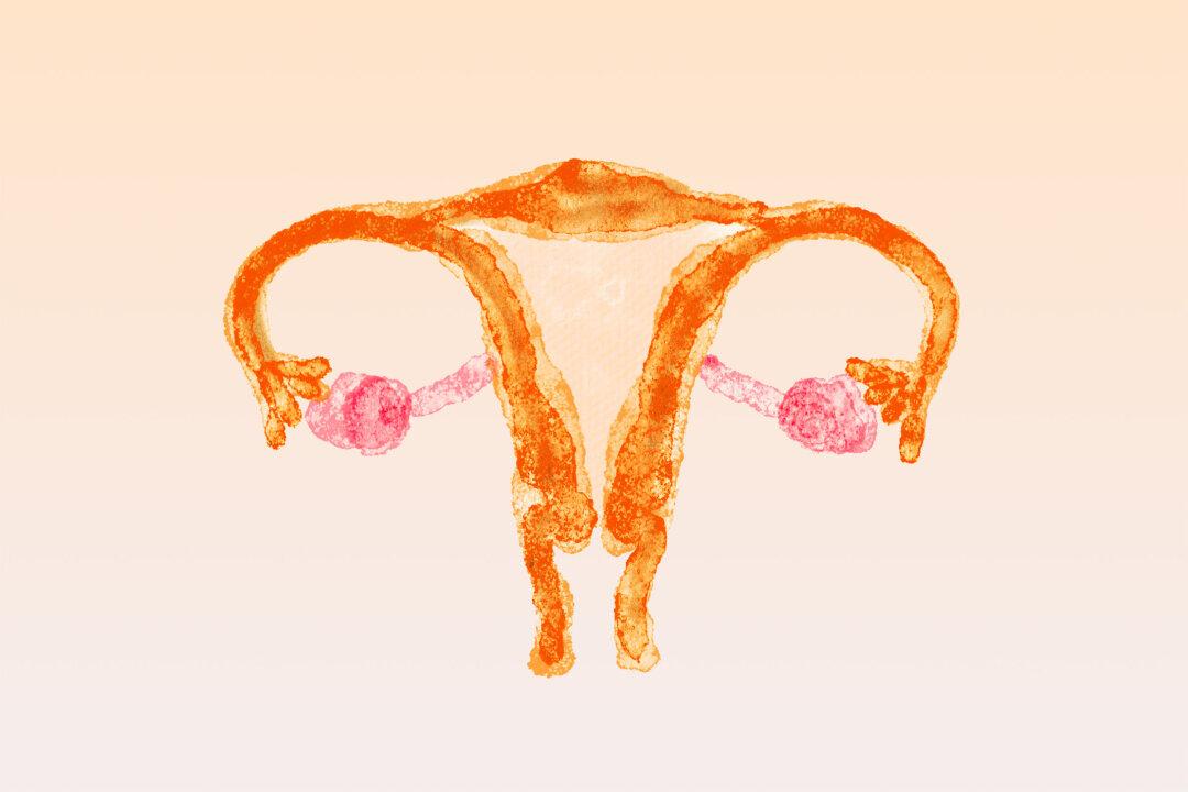 PCOS: One of Women’s Most Misunderstood Conditions