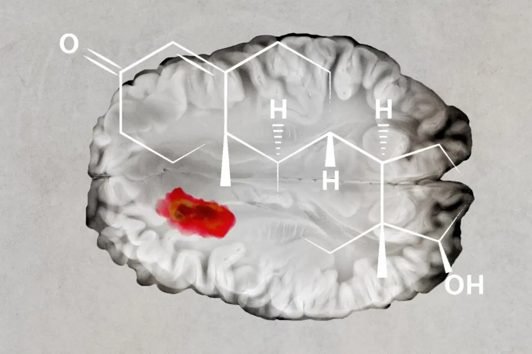 Testosterone May Slow Brain Cancer Growth