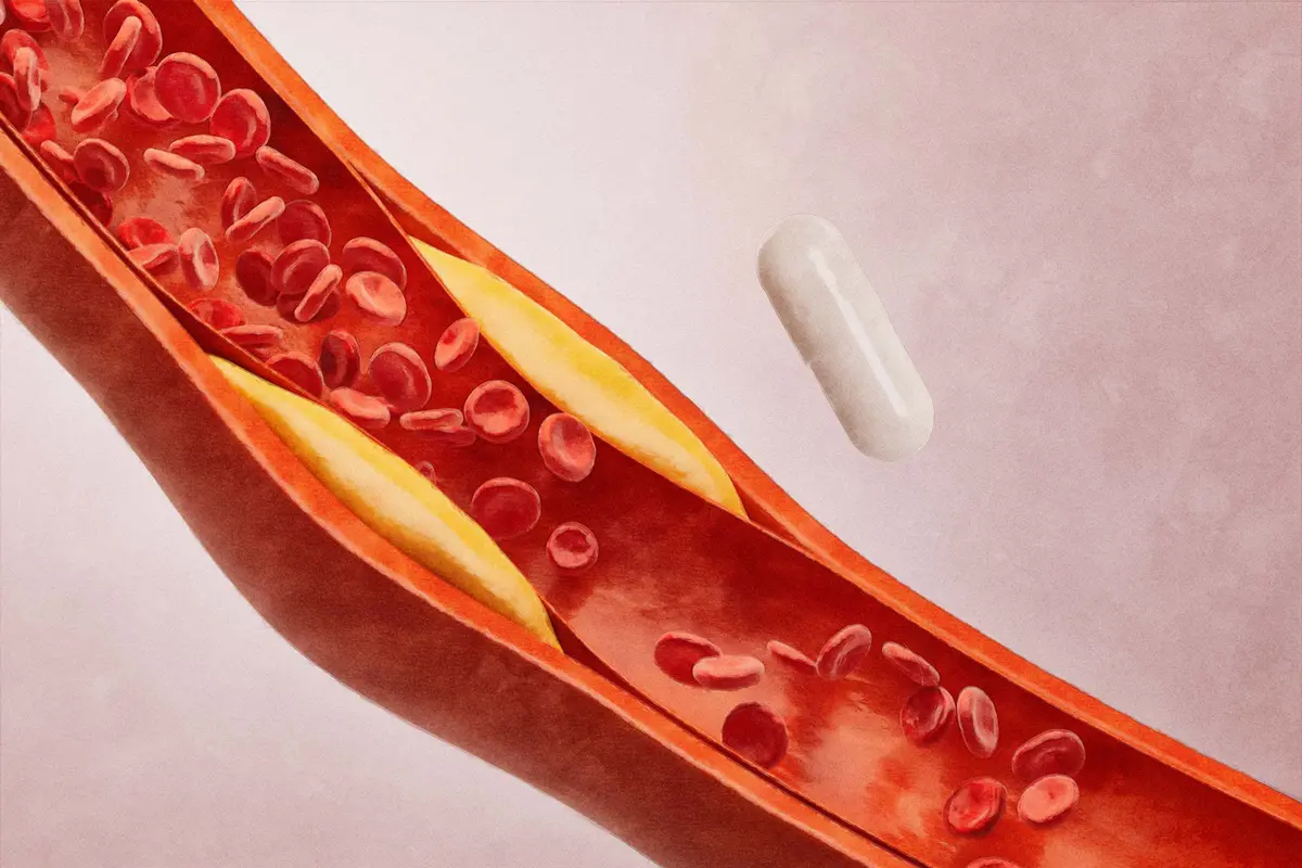 Vitamin K2 May Help Slow Artery Hardening, Study Finds