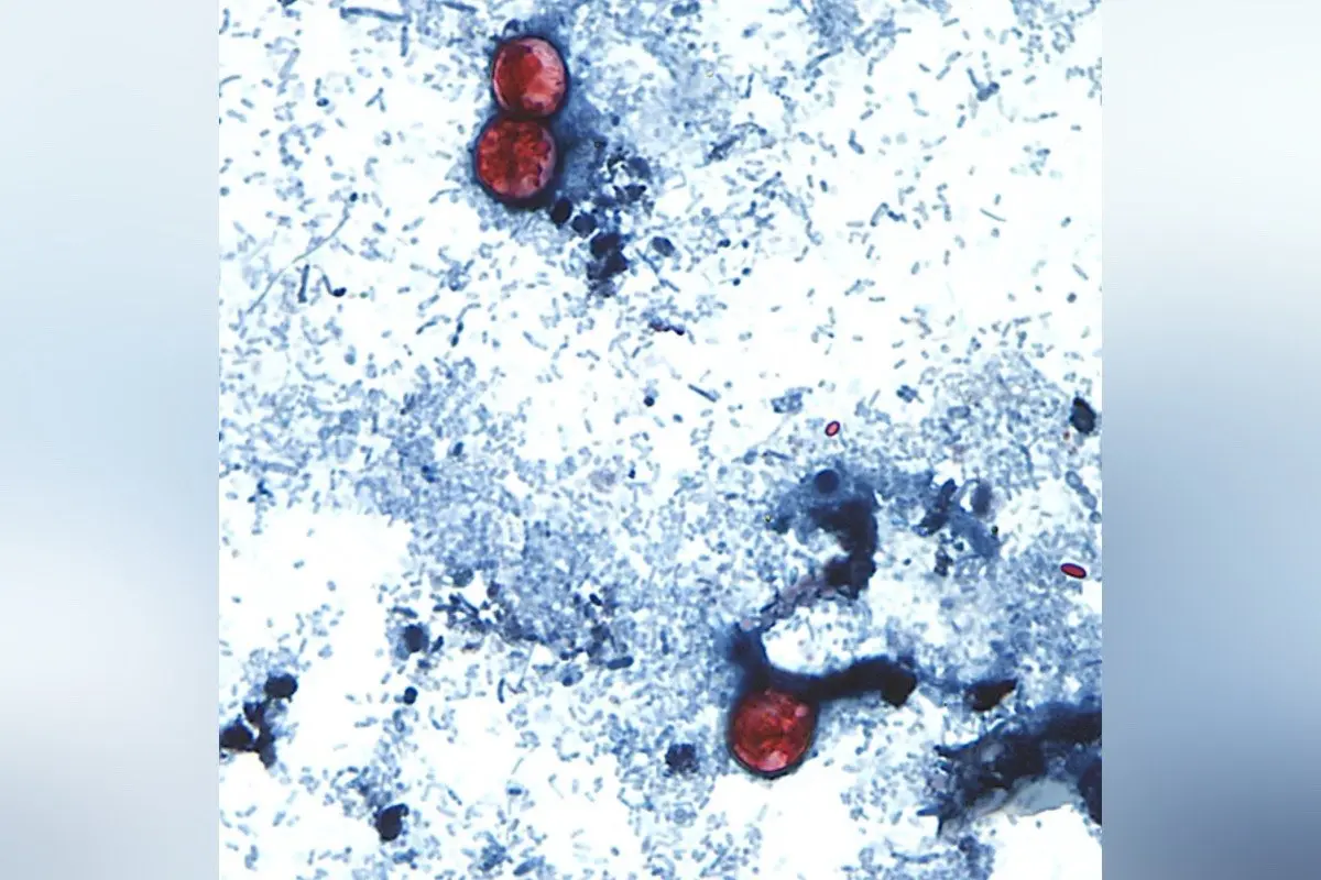 Infections From Diarrhea-Causing Parasite Soar Past 1,000 in Michigan