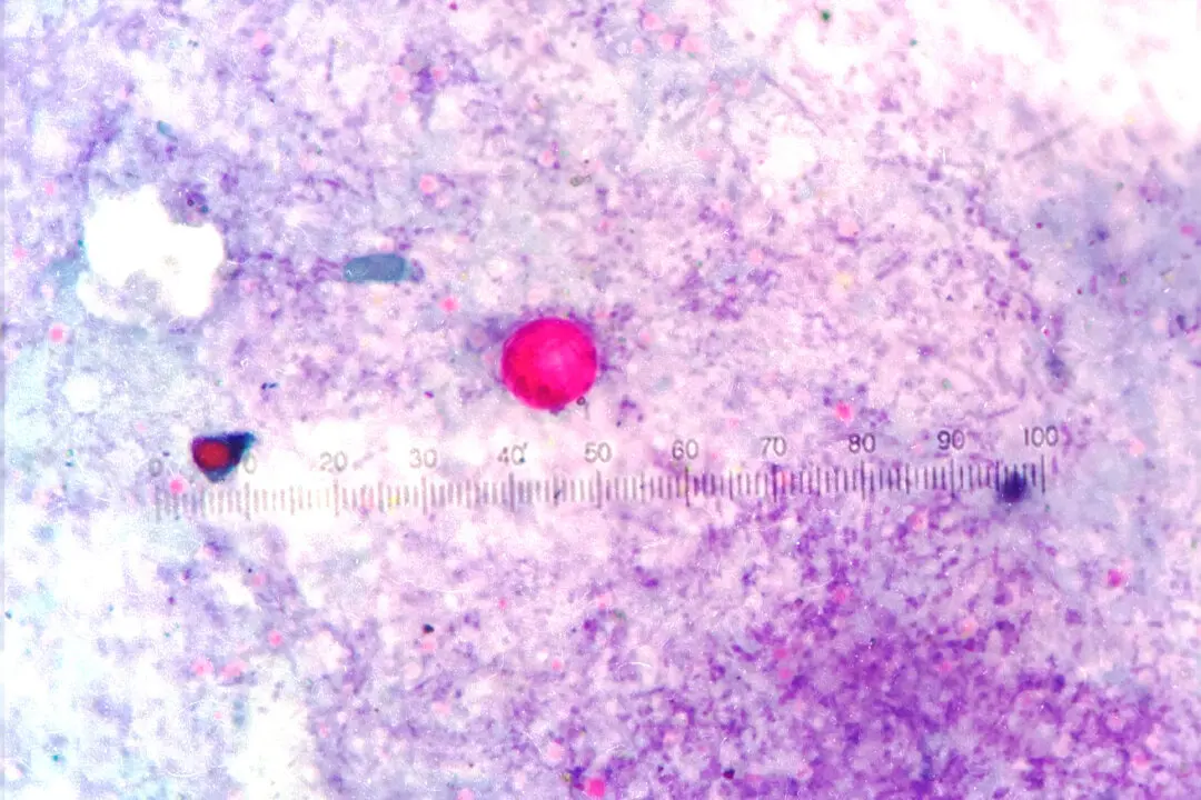 Cyclosporiasis: An Annual Summer Parasitic Infection–How to Protect Yourself
