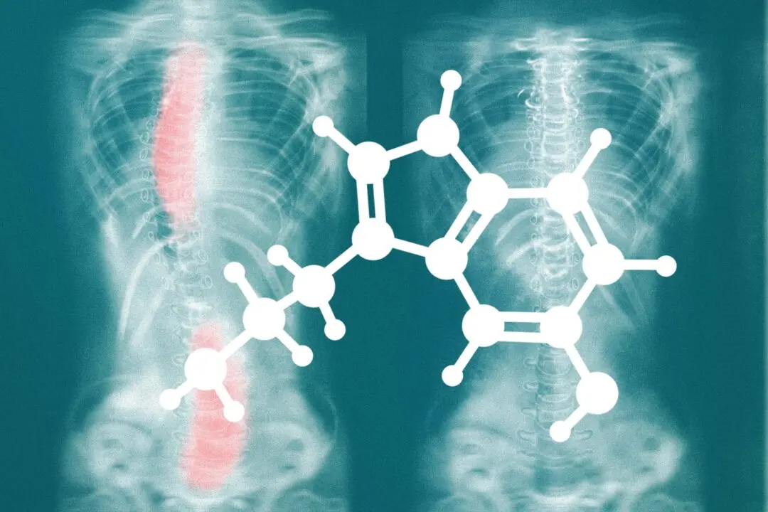 The Serotonin-Melatonin Connection to Scoliosis