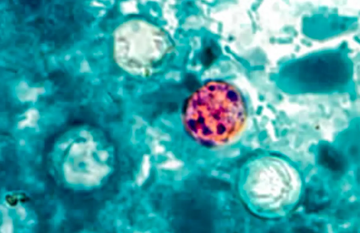 More Than 15,000 Cases of Parasite That Causes Diarrhea in US: CDC
