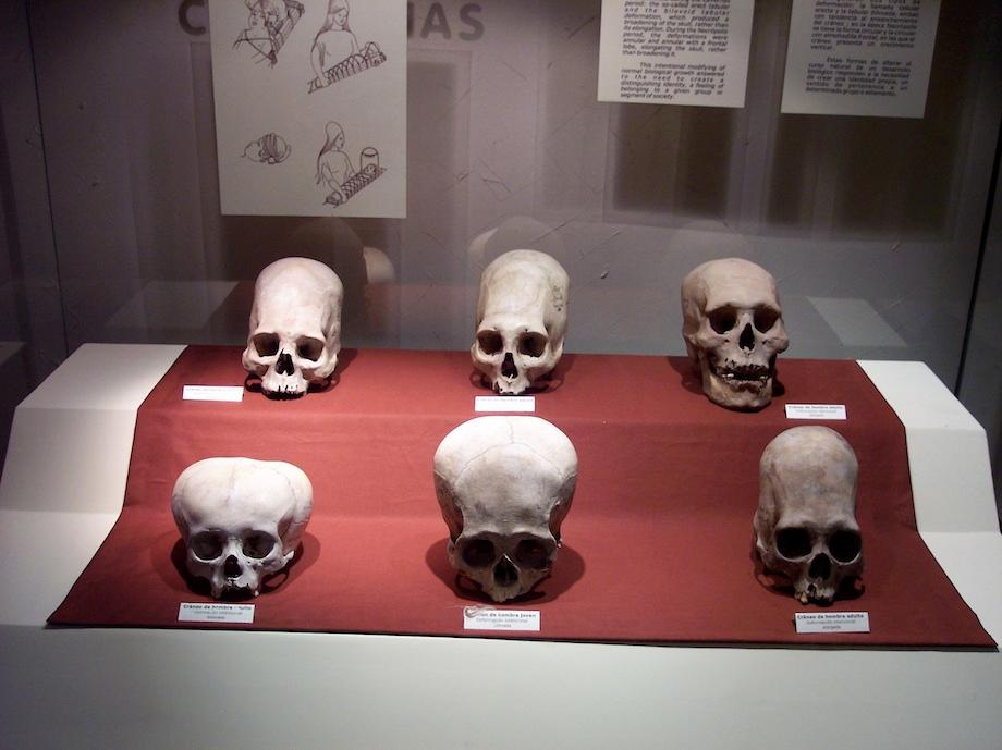 Paracas Skulls