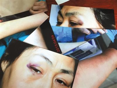 Lawyer Cui Hui was injured in an assault at the Tongzhou District People's Court by judges and bailiffs on April 2. (Beijing News via Chinese Human Rights Defenders)