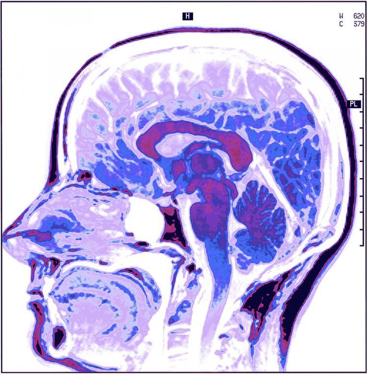 <a><img class="size-medium wp-image-1829926" title="Like a CAT scan, Mr. Feloni's" src="https://www.theepochtimes.com/assets/uploads/2015/09/11scann.jpg" alt="Like a CAT scan, Mr. Feloni's" width="320"/></a>