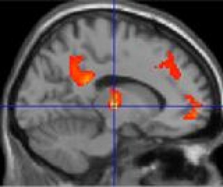 <a><img class="size-medium wp-image-1814560" title="A TRANQUIL BRAIN: Researchers found that tranquil scenes can positively affect the connections between different brain regions. (Michael Hunter/University of Sheffield)" src="https://www.theepochtimes.com/assets/uploads/2015/09/25556Brain.jpg" alt="A TRANQUIL BRAIN: Researchers found that tranquil scenes can positively affect the connections between different brain regions. (Michael Hunter/University of Sheffield)" width="320"/></a>