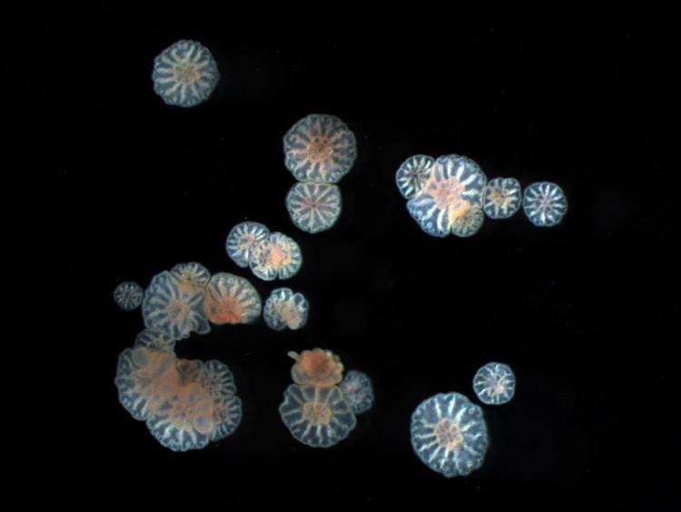 <a><img class="size-full wp-image-1791148" src="https://www.theepochtimes.com/assets/uploads/2015/09/coral-embryos.jpg" alt="" width="750" height="564"/></a>