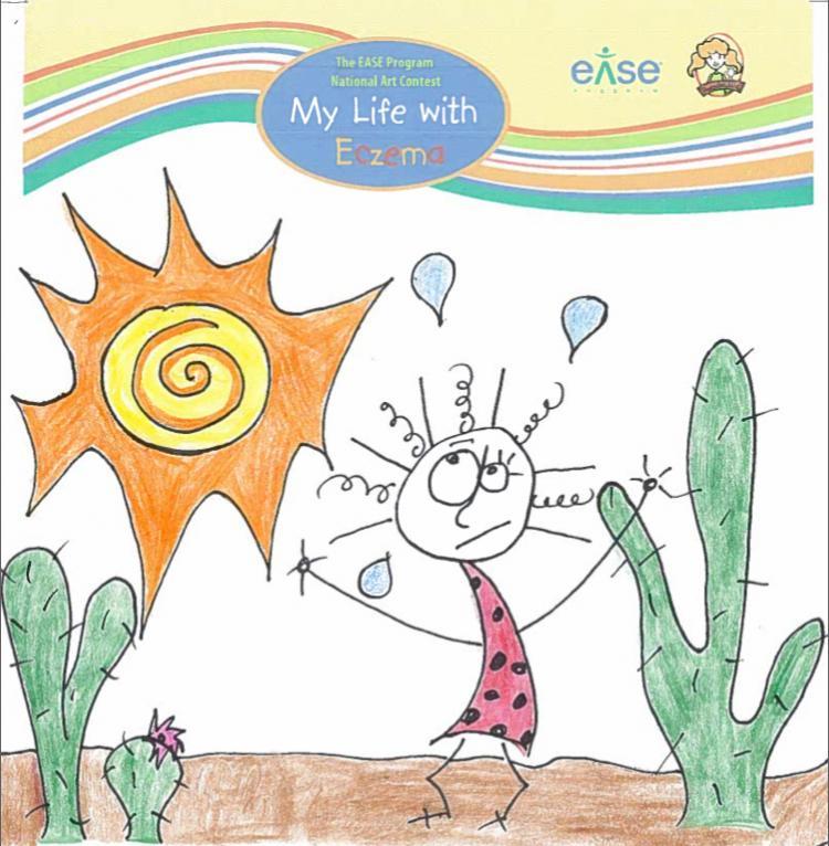 <a><img src="https://www.theepochtimes.com/assets/uploads/2015/09/eczema.jpg" alt="Twelve-year-old Maya Brassard's artwork won a national art contest to support children suffering from eczema. (Eczema Awareness, Support and Education Program)" title="Twelve-year-old Maya Brassard's artwork won a national art contest to support children suffering from eczema. (Eczema Awareness, Support and Education Program)" width="320" class="size-medium wp-image-1808116"/></a>