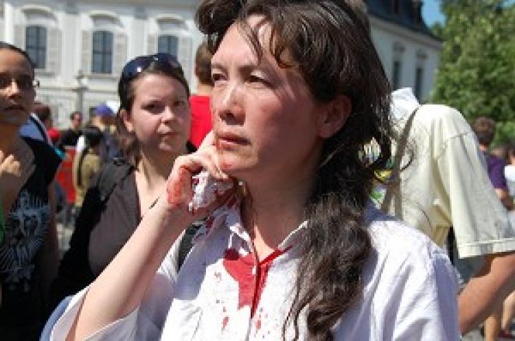 <a><img src="https://www.theepochtimes.com/assets/uploads/2015/09/su.jpg" alt="Falun Gong practitioner Ms. Su, who was pushed down over 20 steps by thugs hired by the Chinese Communist Party, told Slovak media, 'They tried to kill us only because we said 'Falun Dafa is good.' ' (Guan Yuanfang/The Epoch Times)" title="Falun Gong practitioner Ms. Su, who was pushed down over 20 steps by thugs hired by the Chinese Communist Party, told Slovak media, 'They tried to kill us only because we said 'Falun Dafa is good.' ' (Guan Yuanfang/The Epoch Times)" width="320" class="size-medium wp-image-1827787"/></a>