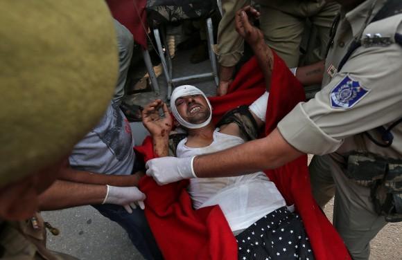 A man who was injured after a bus he was travelling in skidded off a mountain road and fell into a gorge in Jammu and Kashmir's Ramban district, is rushed to a hospital for treatment in Jammu July 16, 2017. (Reuters/Mukesh Gupta)