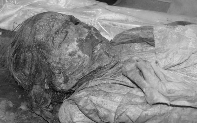 A female Korean mummy from 350 years ago. (<a href="https://www.ncbi.nlm.nih.gov/pmc/articles/PMC4712574/">ncbi.nlm.nih.gov</a>)