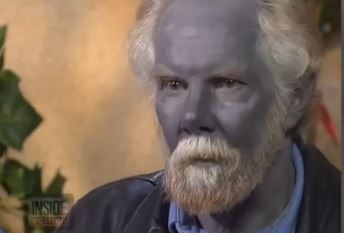 Blue Man Dies: Paul Karason Dead at 62, Had Blue Skin (+Photo) | The ...