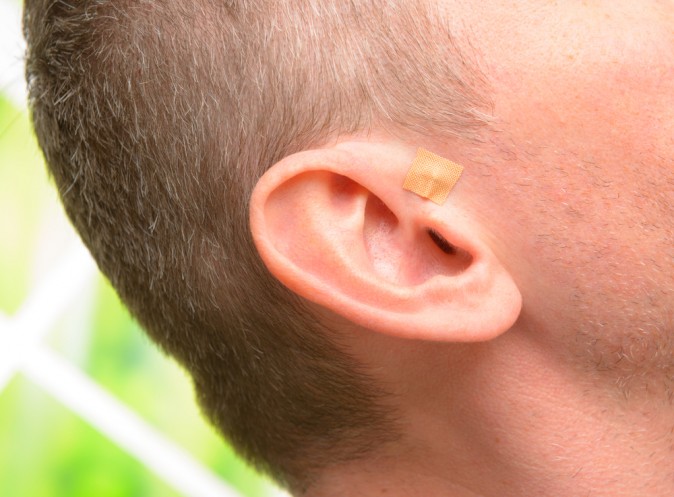 Ear Seeds Explained | Traditional Chinese Medicine | The Epoch Times