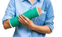 Broke Your Arm? Exercise the Other One to Strengthen It