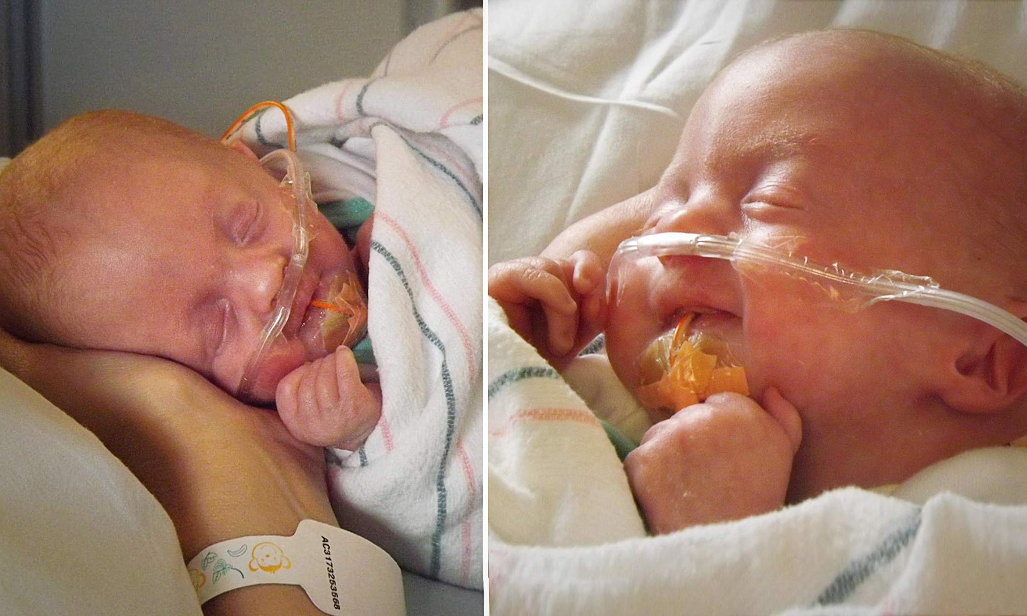 Doctors Call Baby With Trisomy 18 'Incompatible With Life,' Offer Abortion—But She Lives on to Thrive: 'God Doesn't Make Mistakes'