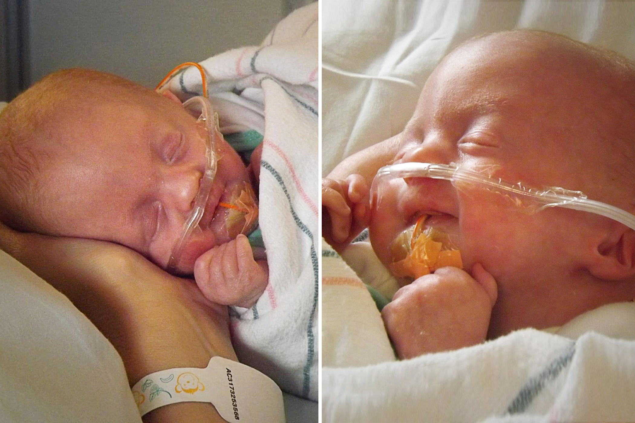 Doctors Call Baby With Trisomy 18 'Incompatible With Life,' Offer Abortion—But She Lives on to Thrive: 'God Doesn't Make Mistakes'